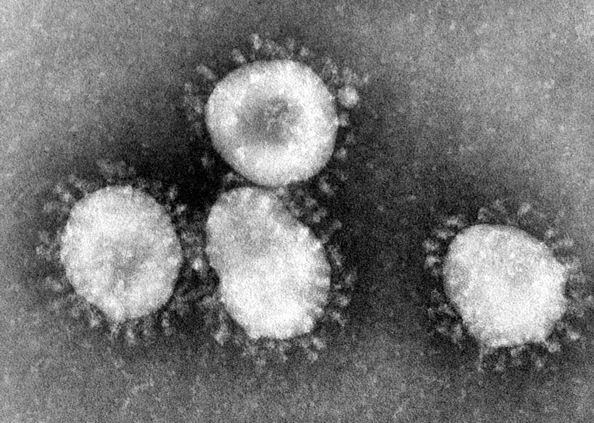 Rapatriement des Français de Wuhan : il faudra "les mettre en quarantaine, car ils peuvent être porteurs du virus sans avoir de symptômes", estime un spécialiste