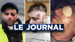 Gilets jaunes : acte XII, au nom des gueules cassées - Journal du vendredi 1er février 2019